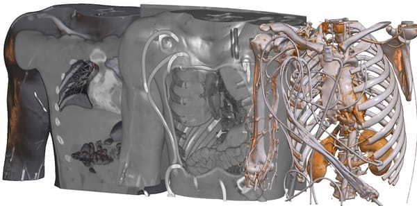 MRIcroGL is a Free DICOM and NIfTI images Viewers